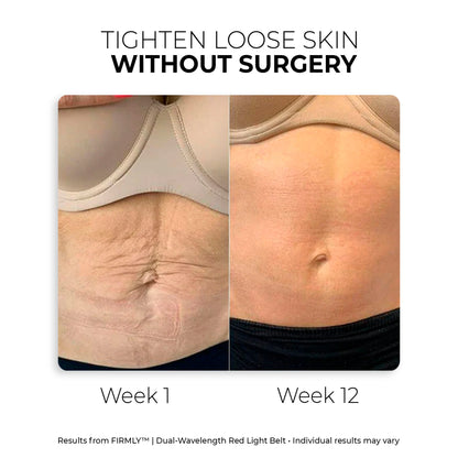 Luméa SculptWrap™ Tighten Loose Skin & Sculpt Your Body — Without Surgery
